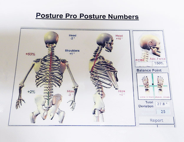 Posture Pro assists our physiotherapists in identifying problem areas, allowing a holistic approach to help you to correct posture.